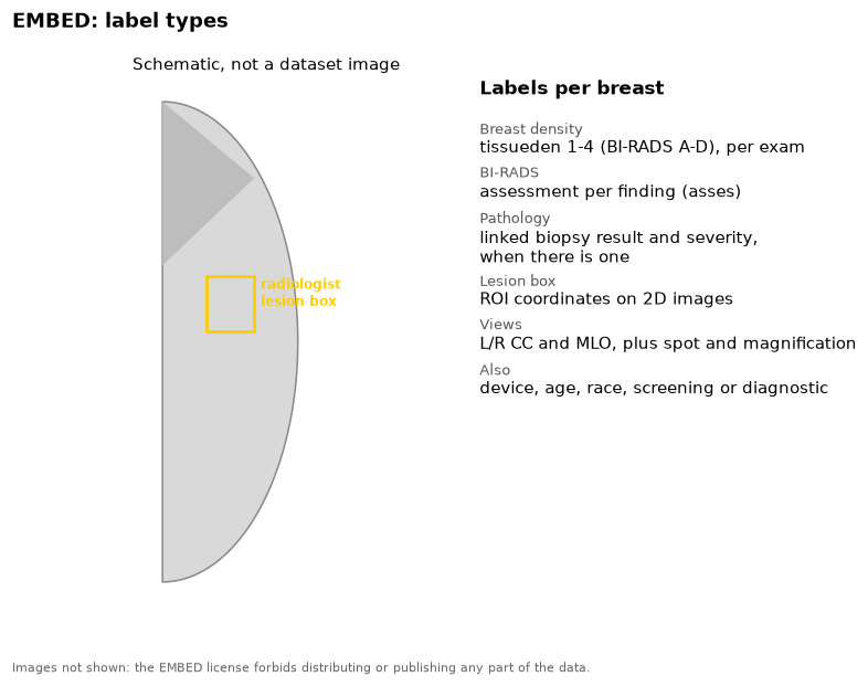 Schematic breast outline with a radiologist lesion box, and the list of EMBED labels