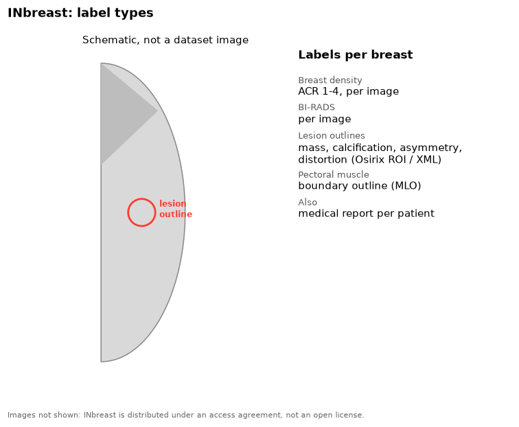 Schematic breast outline with a lesion outline, and the list of INbreast labels
