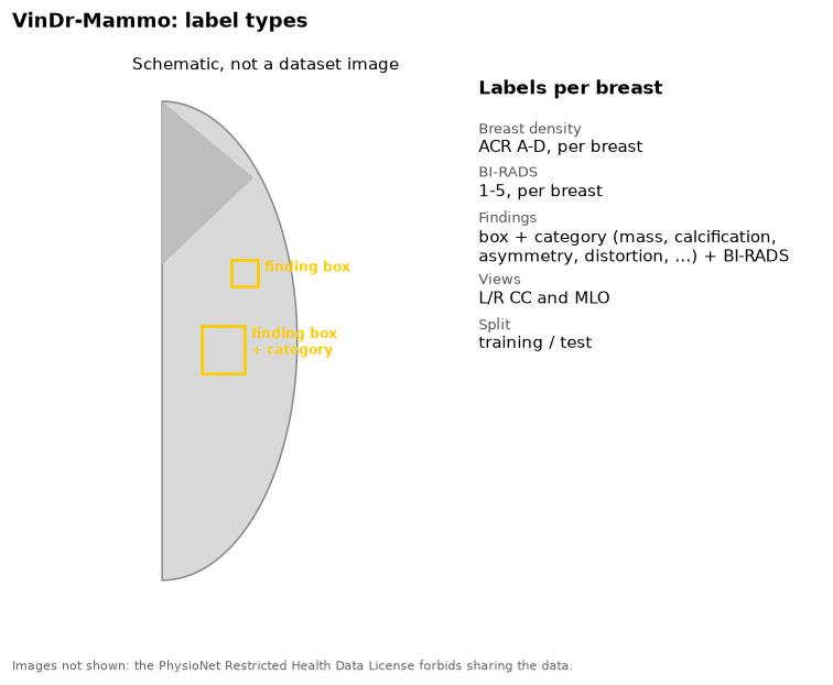 Schematic breast outline with two finding boxes, and the list of VinDr-Mammo labels